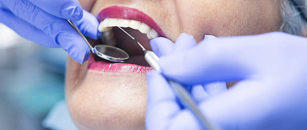 Best Urgent Care for Lost Fillings or Crowns in Douglas, WY